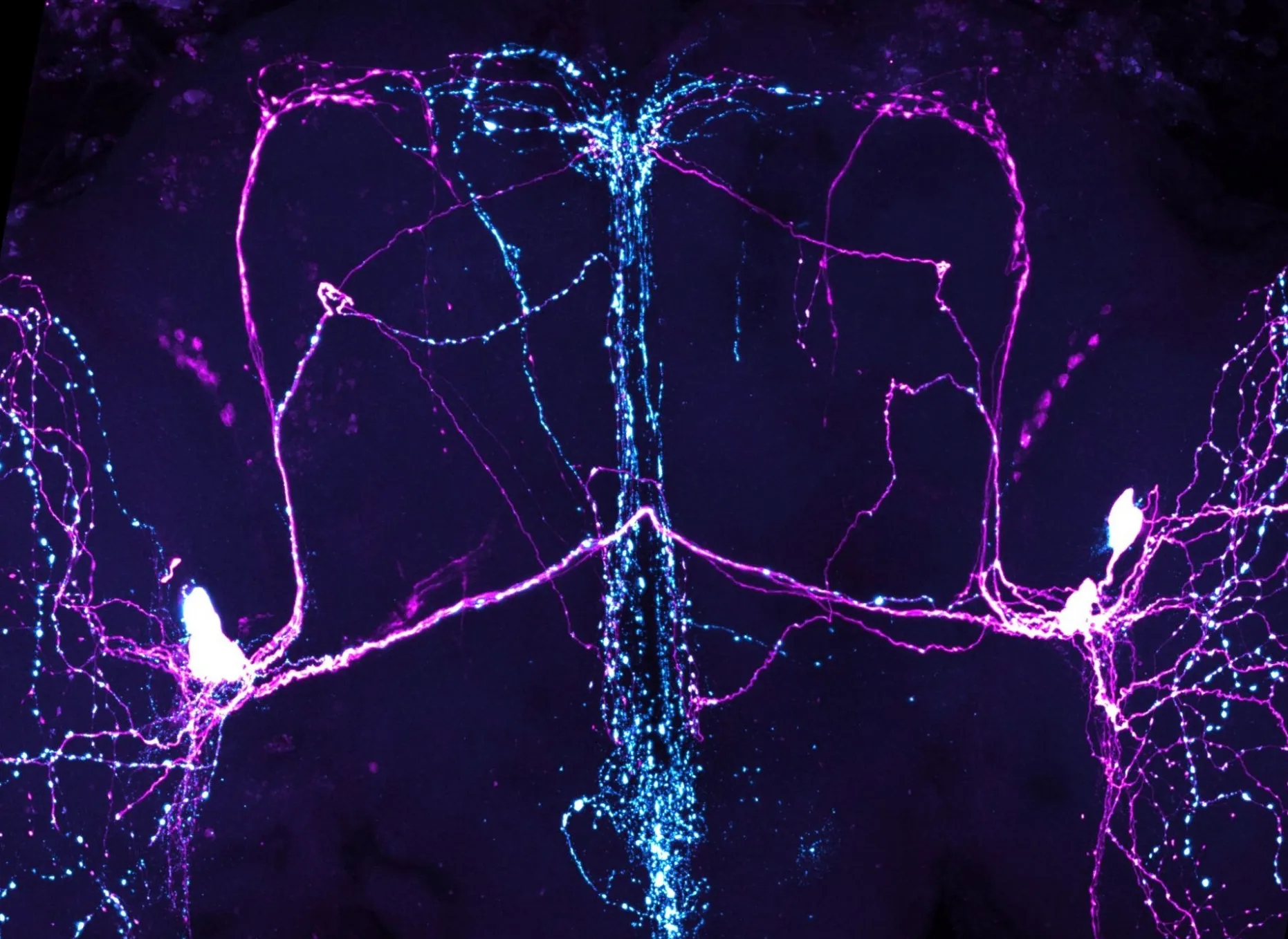 Eva brain rotated